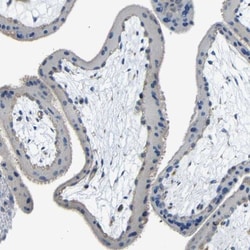 BAG5 Antibody, Novus Biologicals:Antibodies:Primary Antibodies