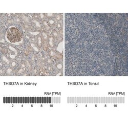 THSD7A Antibody, Novus Biologicals 25 &mu;L, Unlabeled:Antibodies, Polyclonal