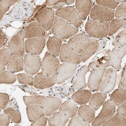 THTPA Antibody, Novus Biologicals:Antibodies:Primary Antibodies