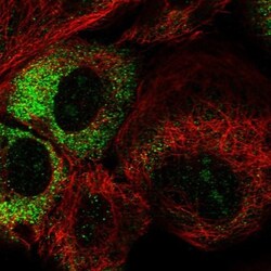 THUMPD3 Antibody, Novus Biologicals:Antibodies:Primary Antibodies