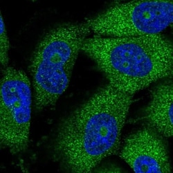 THUMPD3 Antibody, Novus Biologicals:Antibodies:Primary Antibodies