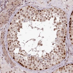 Histamine H2R Antibody, Novus Biologicals:Antibodies:Primary Antibodies