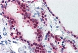 TIA1 Antibody, Novus Biologicals 0.1mg; Unlabeled:Antibodies, Polyclonal