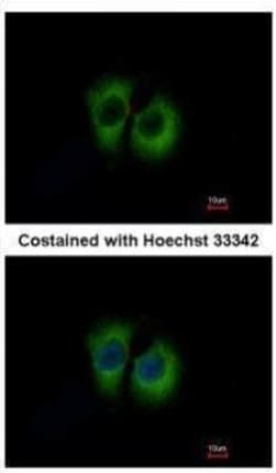 TID1 Antibody, Novus Biologicals 0.1mg; Unlabeled:Antibodies, Polyclonal
