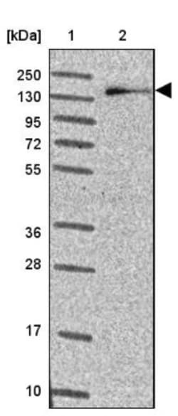 TIF1 alpha Antibody, Novus Biologicals 25 &mu;L | Buy Online | Novus Biologicals | Fisher Scientific