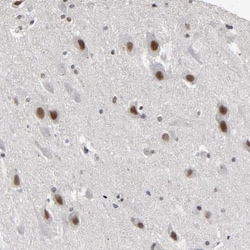 TIF1 gamma Antibody, Novus Biologicals:Antibodies:Primary Antibodies