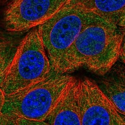 TIGAR/C12orf5 Antibody, Novus Biologicals 25 &mu;L, Unlabeled:Antibodies,