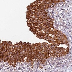 TIGAR/C12orf5 Antibody, Novus Biologicals 25 &mu;L, Unlabeled:Antibodies,