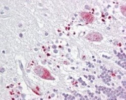 TIGAR/C12orf5 Antibody, Novus Biologicals:Antibodies:Primary Antibodies