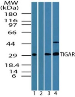 TIGAR/C12orf5 Antibody, Novus Biologicals:Antibodies:Primary Antibodies