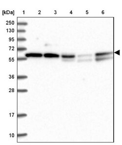 TIGD1 Antibody, Novus Biologicals:Antibodies:Primary Antibodies