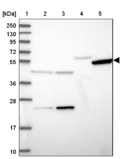 TIGD6 Antibody, Novus Biologicals 25 &mu;L | Buy Online | Novus Biologicals | Fisher Scientific