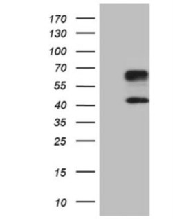 TIM-3 Antibody (OTI2E2), Novus Biologicals 0.1mL; Unlabeled:Antibodies,