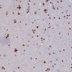 TIM21 Antibody, Novus Biologicals 25 &mu;L, Unlabeled:Antibodies, Polyclonal