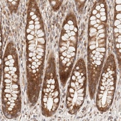 TIMM17A Antibody, Novus Biologicals 25 &mu;L; Unlabeled:Antibodies, Polyclonal