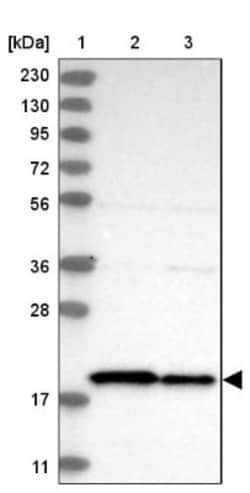 TIMM17B Antibody, Novus Biologicals:Antibodies:Primary Antibodies