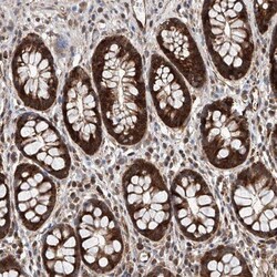TIMM23 Antibody, Novus Biologicals 0.1mL; Unlabeled:Antibodies, Polyclonal