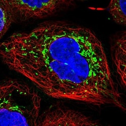 TIMM44 Antibody, Novus Biologicals 0.1mL; Unlabeled:Antibodies, Polyclonal