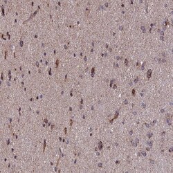 TIMM44 Antibody, Novus Biologicals 0.1mL; Unlabeled:Antibodies, Polyclonal
