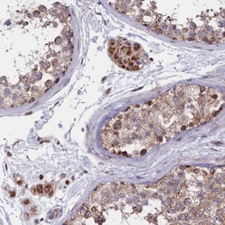 TIMM44 Antibody, Novus Biologicals 0.1mL; Unlabeled:Antibodies, Polyclonal
