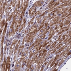 TIMM44 Antibody, Novus Biologicals 0.1mL; Unlabeled:Antibodies, Polyclonal