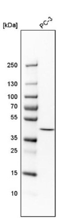 TIMM44 Antibody, Novus Biologicals 0.1mL; Unlabeled:Antibodies, Polyclonal