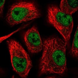 TIMM50 Antibody, Novus Biologicals 0.1mL; Unlabeled:Antibodies, Polyclonal