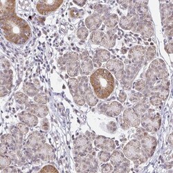 TIMM50 Antibody, Novus Biologicals 0.1mL; Unlabeled:Antibodies, Polyclonal