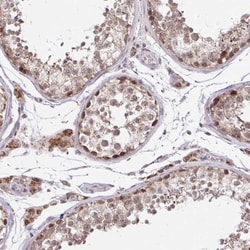 TIMM50 Antibody, Novus Biologicals 0.1mL; Unlabeled:Antibodies, Polyclonal