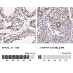 TIMM50 Antibody, Novus Biologicals 0.1mL; Unlabeled:Antibodies, Polyclonal