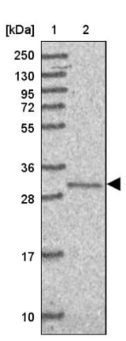 TIMMDC1 Antibody, Novus Biologicals 0.1mL; Unlabeled:Antibodies, Polyclonal