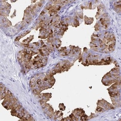 TIMP-1 Antibody, Novus Biologicals 25 &mu;L, Unlabeled:Antibodies, Polyclonal