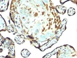 TIMP-3 Antibody, Novus Biologicals 0.2mg:Antibodies, Polyclonal