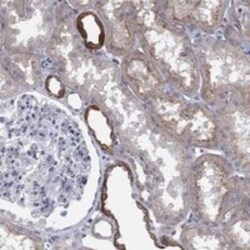 TIN-Ag Rabbit anti-Human, Polyclonal, Novus Biologicals 100 &mu;g | Buy Online | Novus Biologicals | Fisher Scientific