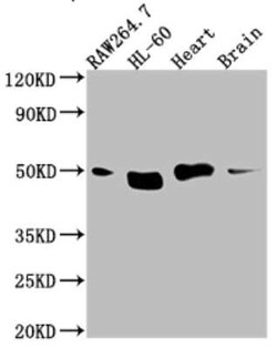 TIN2 Antibody (5G11), Novus Biologicals 100 &mu;g; Unconjugated:Antibodies,