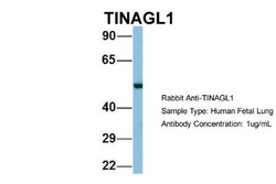 TINAGL1 Antibody, Novus Biologicals:Antibodies:Primary Antibodies