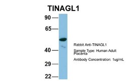 TINAGL1 Antibody, Novus Biologicals:Antibodies:Primary Antibodies