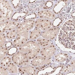 TIP120A Antibody, Novus Biologicals 25 &mu;L, Unlabeled:Antibodies, Polyclonal