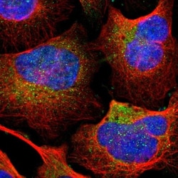TIP30 Antibody, Novus Biologicals 0.1mL; Unlabeled:Antibodies, Polyclonal