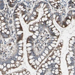 TIP30 Antibody, Novus Biologicals 0.1mL; Unlabeled:Antibodies, Polyclonal