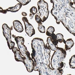 TIP30 Antibody, Novus Biologicals 0.1mL; Unlabeled:Antibodies, Polyclonal
