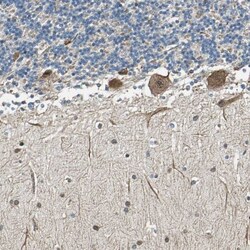 TIP30 Antibody, Novus Biologicals 0.1mL; Unlabeled:Antibodies, Polyclonal