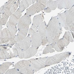 TIP30 Antibody, Novus Biologicals 0.1mL; Unlabeled:Antibodies, Polyclonal