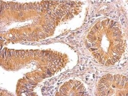 TIP30 Antibody, Novus Biologicals 0.1mL; Unlabeled:Antibodies, Polyclonal