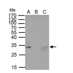 TIP30 Antibody, Novus Biologicals 0.1mL; Unlabeled:Antibodies, Polyclonal