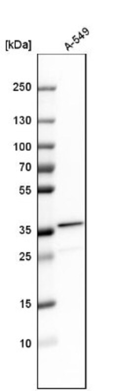 TIP30 Antibody, Novus Biologicals 0.1mL; Unlabeled:Antibodies, Polyclonal