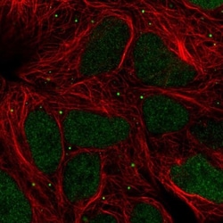 TIPIN Antibody, Novus Biologicals 25 &mu;L, Unlabeled:Antibodies, Polyclonal