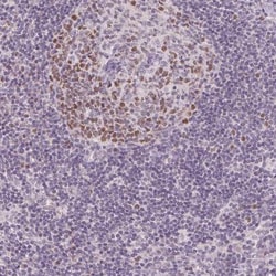 TIPIN Antibody, Novus Biologicals 0.1mL; Unlabeled:Antibodies, Polyclonal