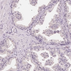 TIPIN Antibody, Novus Biologicals 0.1mL; Unlabeled:Antibodies, Polyclonal