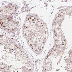 TIPIN Antibody, Novus Biologicals 0.1mL; Unlabeled:Antibodies, Polyclonal